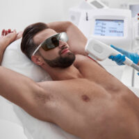 Men’s Hair Removal